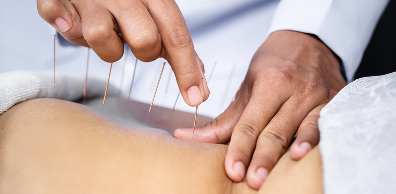 chronic pain acupuncture